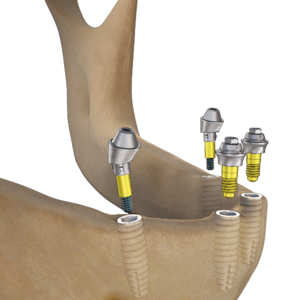 [Translate to Deutsch:] 