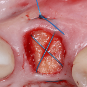 [Translate to Deutsch:] 