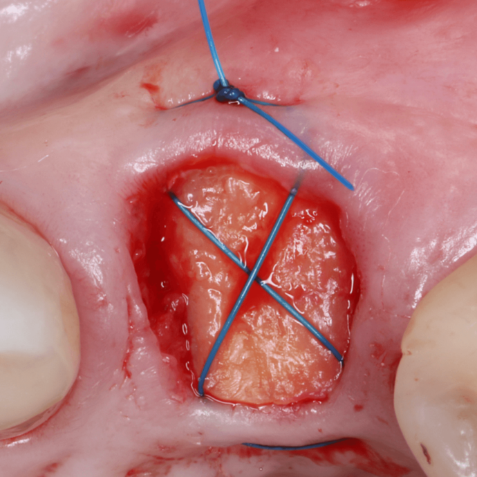 [Translate to Deutsch:] 