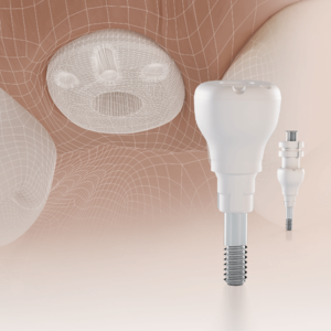 [Translate to Deutsch:] 