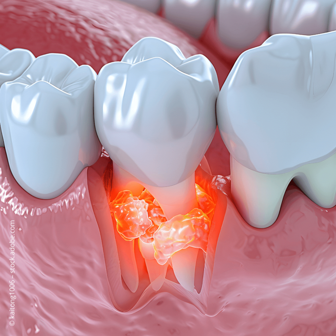 [Translate to Deutsch:] 