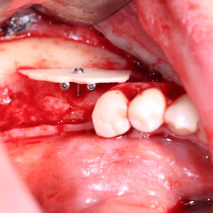 [Translate to Deutsch:] 