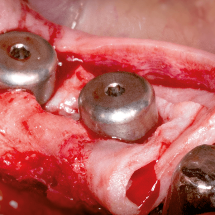 [Translate to Deutsch:] 