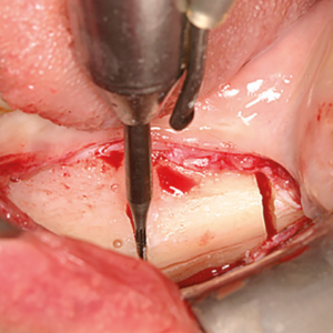 [Translate to Deutsch:] 