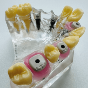 [Translate to Deutsch:] 