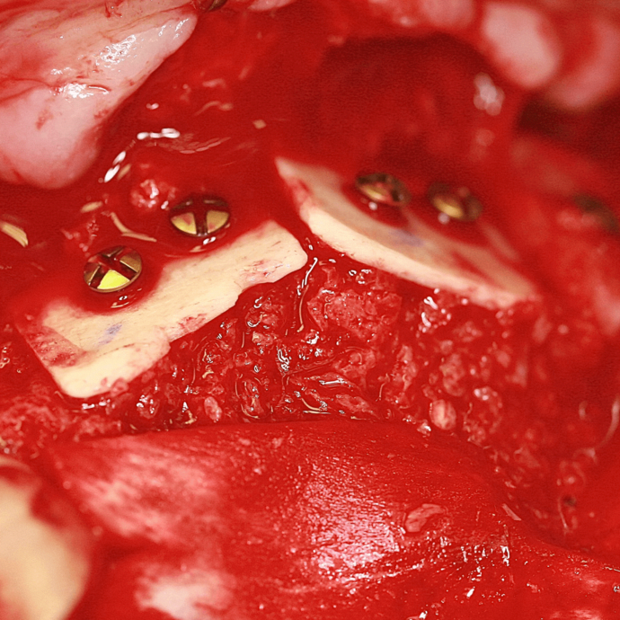 [Translate to Deutsch:] 