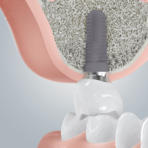 [Translate to Deutsch:] 