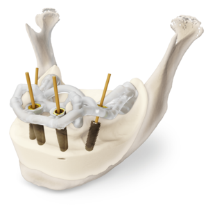 [Translate to Deutsch:] 