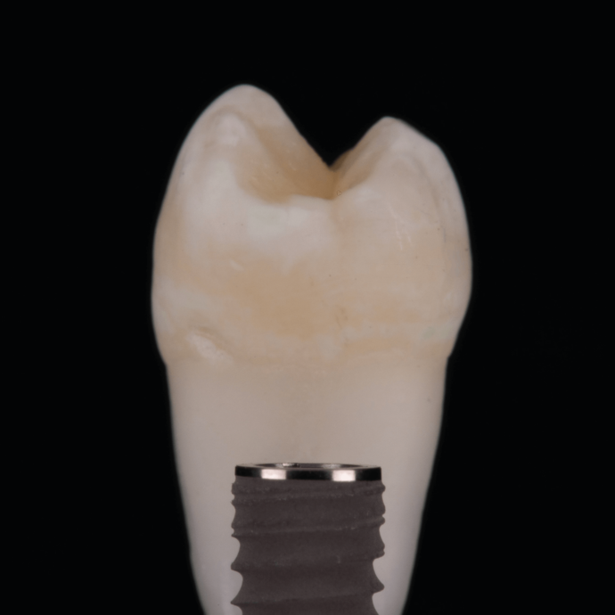 [Translate to Deutsch:] 