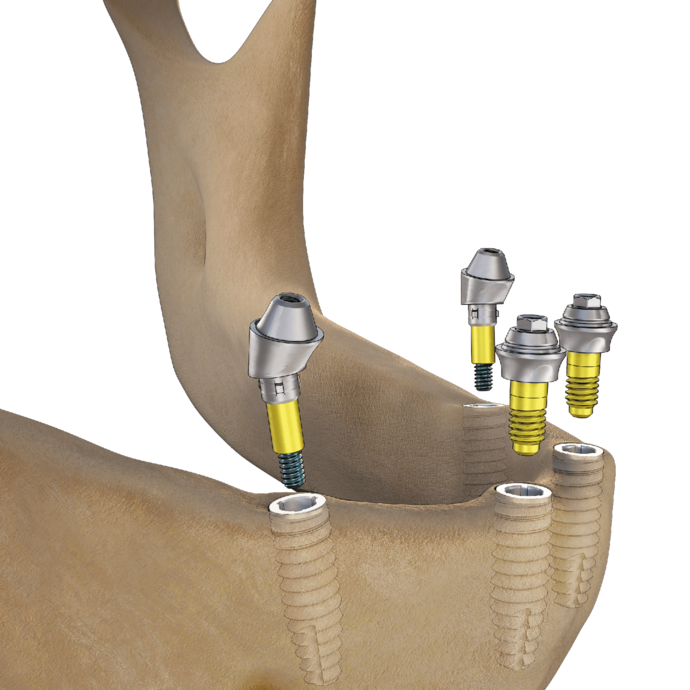 [Translate to Deutsch:] 