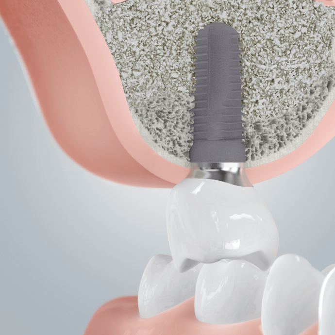 [Translate to Deutsch:] 