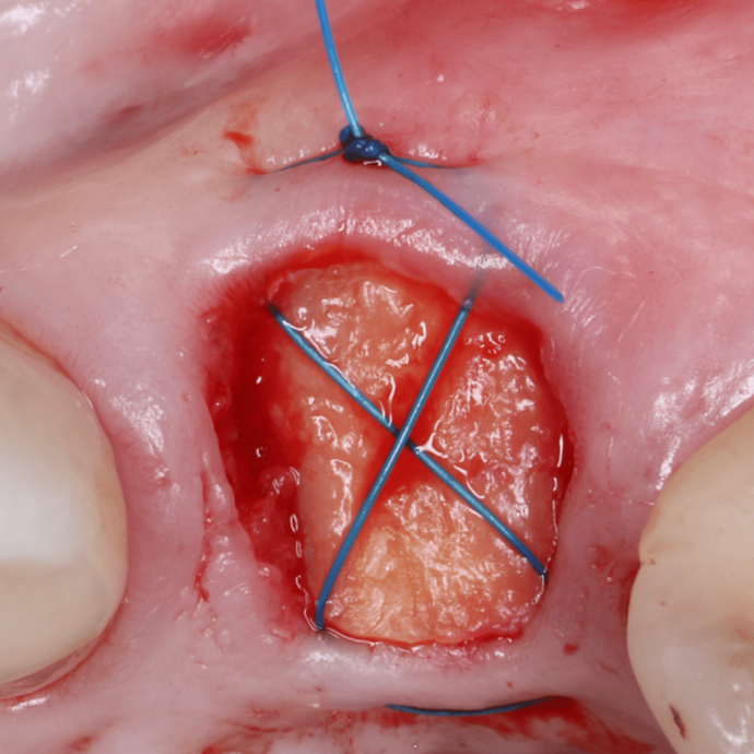 [Translate to Deutsch:] 