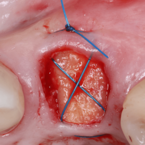 [Translate to Deutsch:] 