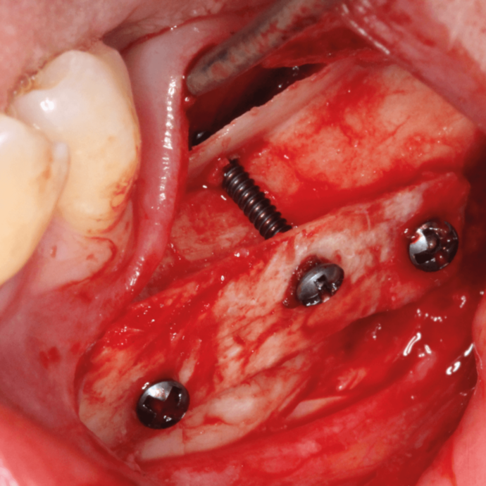 [Translate to Deutsch:] 