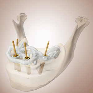 [Translate to Deutsch:] 