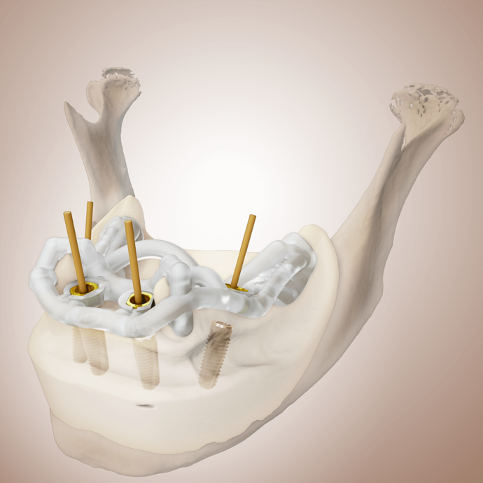 [Translate to Deutsch:] 