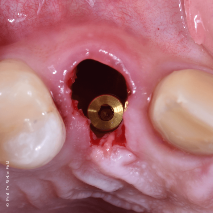 [Translate to Deutsch:] 