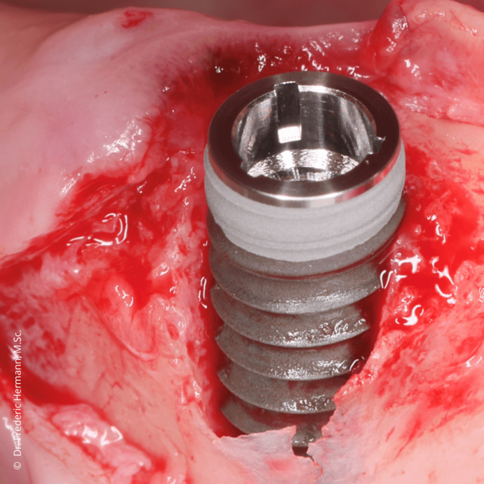 [Translate to Deutsch:] 