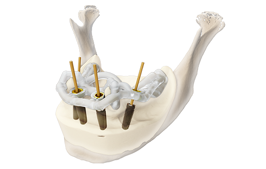 Camlog Geschichte 2018 DEDICAM Implantatplanungsservice