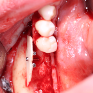 [Translate to Deutsch:] 