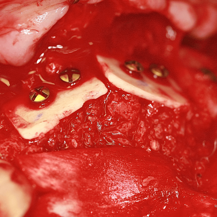 [Translate to Deutsch:] 