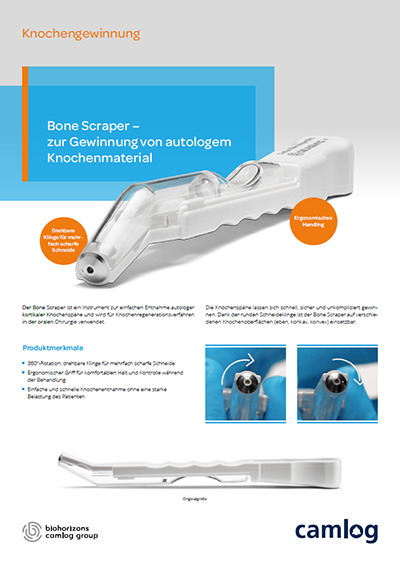 Bone Scraper – zur Gewinnung von autologem Knochenmaterial